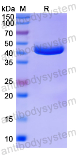 Recombinant Human TRPC1 Protein, N-His