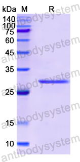 Recombinant Human MAPKAPK2 Protein, N-His