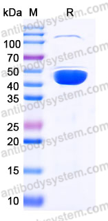 Recombinant Human DHPS Protein, C-His