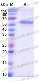 Recombinant Human CCT3 Protein, N-His
