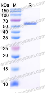 Recombinant Human ARRB1 Protein, C-His