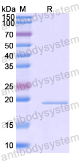 Recombinant Human HOXA1 Protein, N-His-SUMO