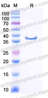 Recombinant Human CTCF Protein, Tag free