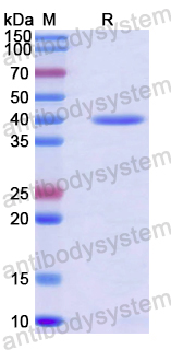 Recombinant Human VPS41 Protein, N-His