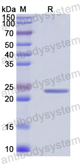 Recombinant Human TSC2 Protein, N-His