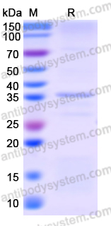 Recombinant Human SULT1E1 Protein, N-His