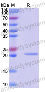 Recombinant Human GMPS Protein, N-His