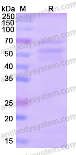 Recombinant Human LIG4 Protein, N-His