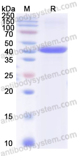 Recombinant Human GNAQ Protein, N-His