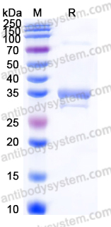 Recombinant Human SULT1A2 Protein, N-His