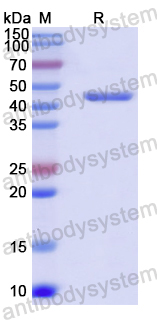 Recombinant Human SERPINH1 Protein, N-His