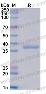 Recombinant Human PEX5 Protein, N-His