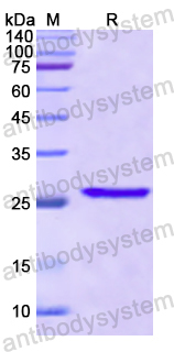 Recombinant Human CDK9 Protein, N-His