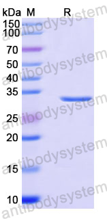 Recombinant Human PPT1 Protein, N-His
