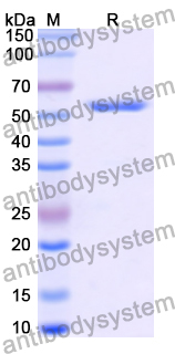 Recombinant Human CCT4 Protein, N-His