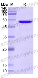 Recombinant Human ANXA11 Protein, N-His