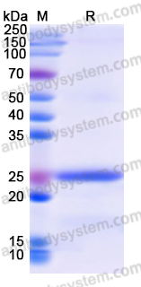 Recombinant Human FXR1 Protein, N-His