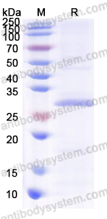 Recombinant Human GZMM Protein, N-His