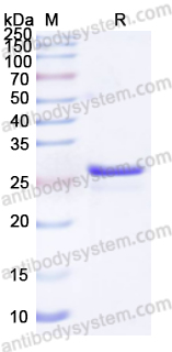 Recombinant Human RAB7A Protein, N-His