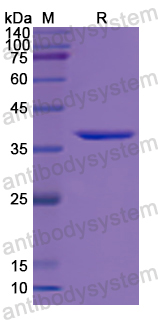 Recombinant Human RAB28 Protein, N-GST