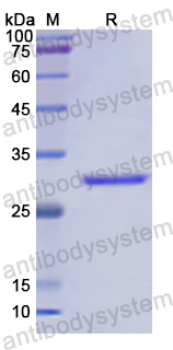 Recombinant Human RORC/NR1F3/RORgT Protein, N-His