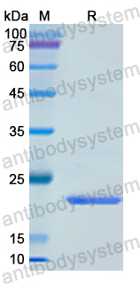 Recombinant Human DUSP3 Protein, N-His