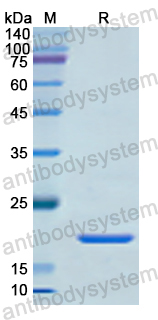Recombinant Human MMP15 Protein, N-His