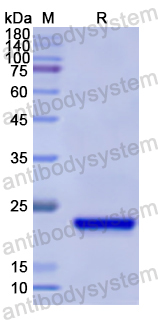 Recombinant Human NOVA1 Protein, N-His
