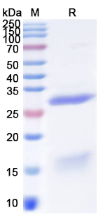 Recombinant Human NOVA1 Protein, N-His