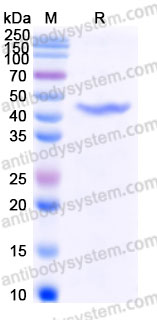 Recombinant Human GALK1 Protein, C-His