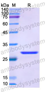 Recombinant Human RENBP Protein, N-His