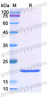Recombinant Human MECP2 Protein, N-His