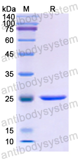 Recombinant Human HCFC1 Protein, N-His