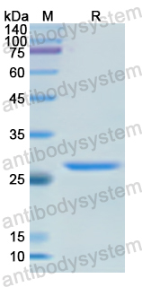 Recombinant Human IRAK1 Protein, N-His