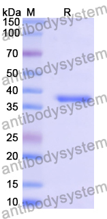 Recombinant Human CAV2 Protein, N-GST & C-His