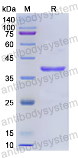 Recombinant Human PSMD7 Protein, N-His
