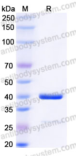 Recombinant Human UBE2D1 Protein, N-GST