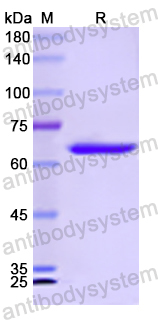 Recombinant Human SGSH Protein, N-GST