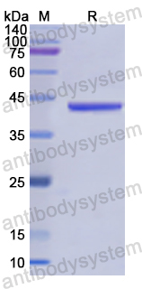 Recombinant Human STAT5B Protein, N-His