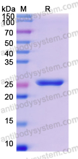 Recombinant Human USP11 Protein, N-His