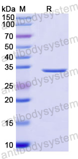 Recombinant Human XK/XRG1 Protein, N-GST & C-His