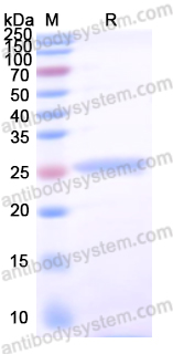 Recombinant Human ADCY7 Protein, N-His