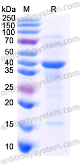 Recombinant Human LUM/Lumican Protein, N-His