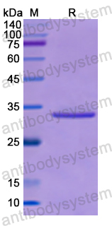 Recombinant Human CNN1 Protein, N-His