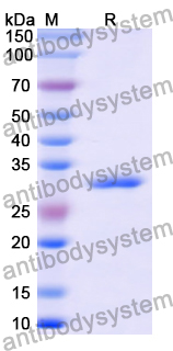 Recombinant Human NEK2 Protein, N-His