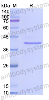 Recombinant Human FUT6 Protein, N-His