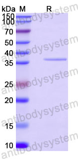 Recombinant Human MYOM1 Protein, N-His