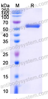Recombinant Human KPNA2 Protein, N-His