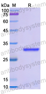 Recombinant Human KPNA1 Protein, N-His