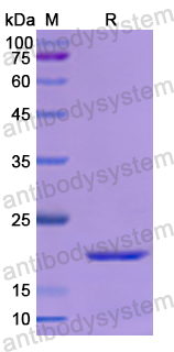Recombinant Human JAK3 Protein, N-His